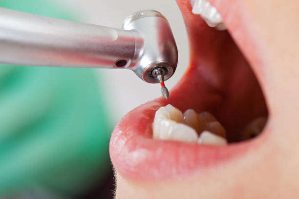 Best Urgent Tooth Repair  in Whitg, IN